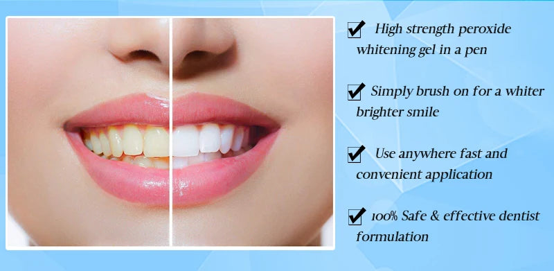 Stilou pentru albirea dintilor White Teeth, Efero, 5ml
