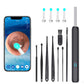 Dispozitiv curatare urechi, LED, 1080P, Cu accesorii, Compatibil cu Android/iOS, Negru sau Alb